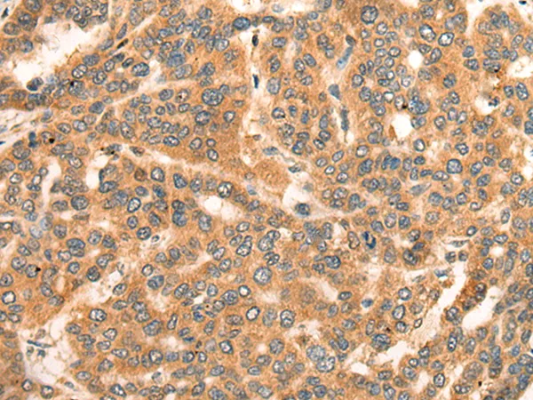 Centaurin alpha 2 (ADAP2) Rabbit Polyclonal Antibody - image 1