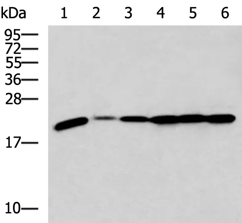 RPL17 Rabbit Polyclonal Antibody - image 1