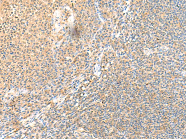 SRCRB4D (SSC4D) Rabbit Polyclonal Antibody - image 1
