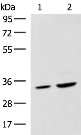 SCGN Rabbit Polyclonal Antibody - image 1