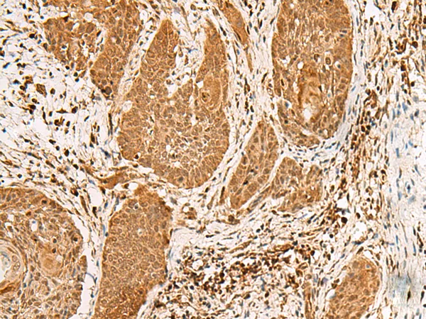 PPOX Rabbit Polyclonal Antibody - image 1