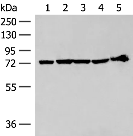 CoCoA (CALCOCO1) Rabbit Polyclonal Antibody - image 1