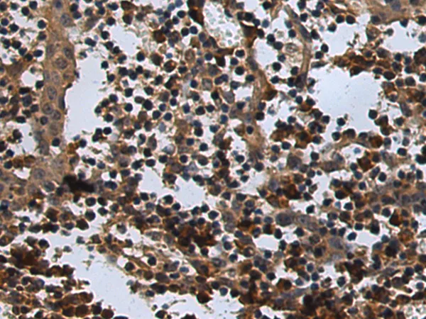 CGBP (CXXC1) Rabbit Polyclonal Antibody - image 1
