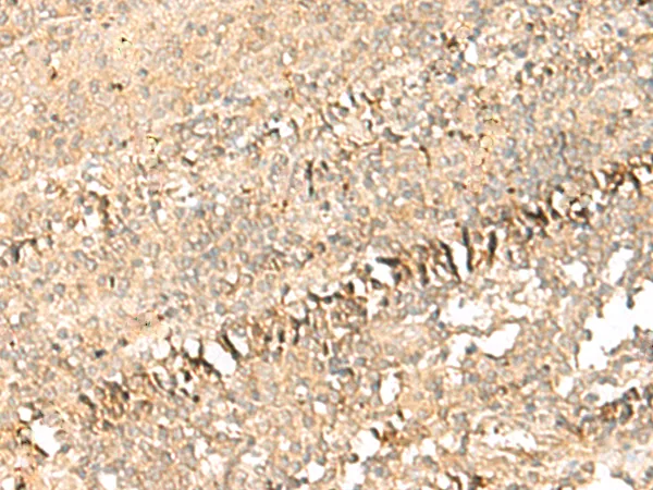 PSD4 Rabbit Polyclonal Antibody - image 1