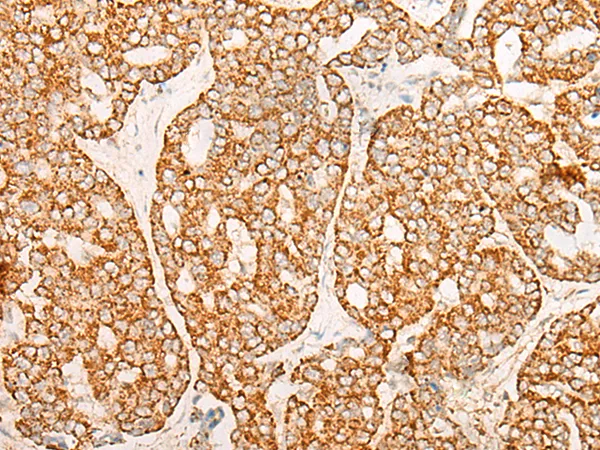 CHAC2 Rabbit Polyclonal Antibody - image 1