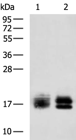 NPC2 Rabbit Polyclonal Antibody - image 1