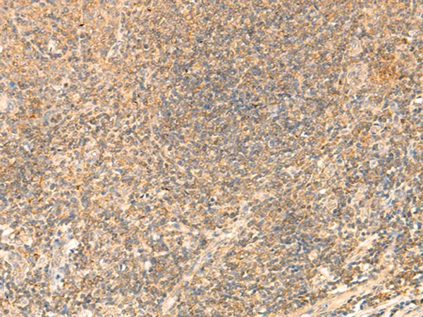 PDAP1 Rabbit Polyclonal Antibody - image 1