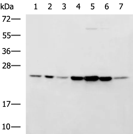 Proteasome subunit beta type 2 (PSMB2) Rabbit Polyclonal Antibody - image 1