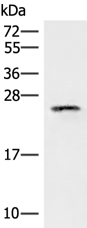 EIF3K Rabbit Polyclonal Antibody - image 1