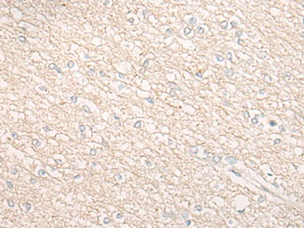 CHMP2B Rabbit Polyclonal Antibody - image 1