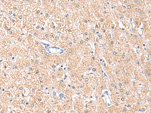 MLKL Rabbit Polyclonal Antibody - image 1