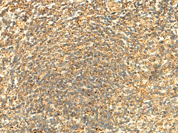 ABHD10 Rabbit Polyclonal Antibody - image 1