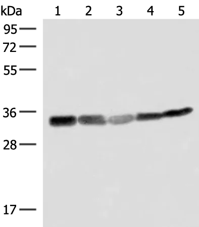 ECH1 Rabbit Polyclonal Antibody - image 1