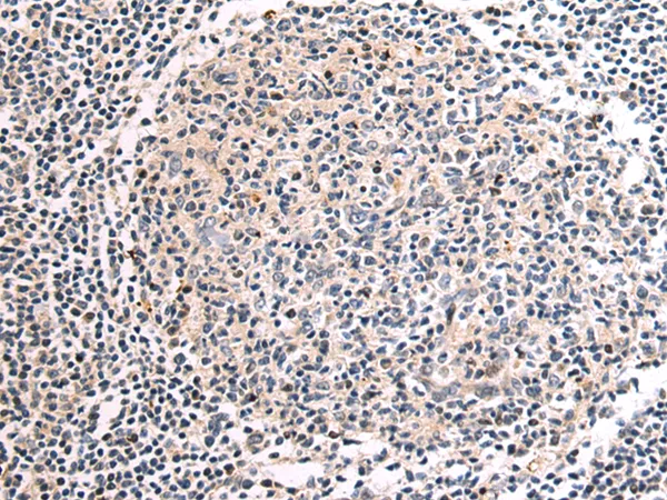 EIF2B2 Rabbit Polyclonal Antibody - image 1