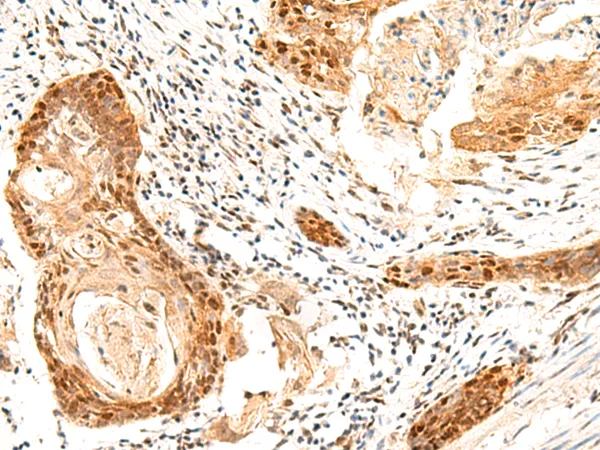 SETMAR Rabbit Polyclonal Antibody - image 1