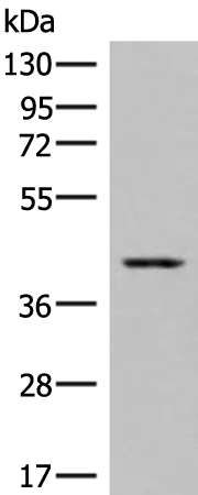 DHPS Rabbit Polyclonal Antibody - image 1