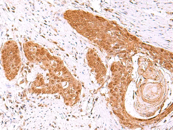 FDPS Rabbit Polyclonal Antibody - image 1