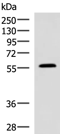 PEPD Rabbit Polyclonal Antibody - image 1