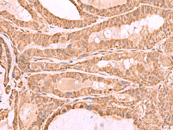 CDC20 Rabbit Polyclonal Antibody - image 1