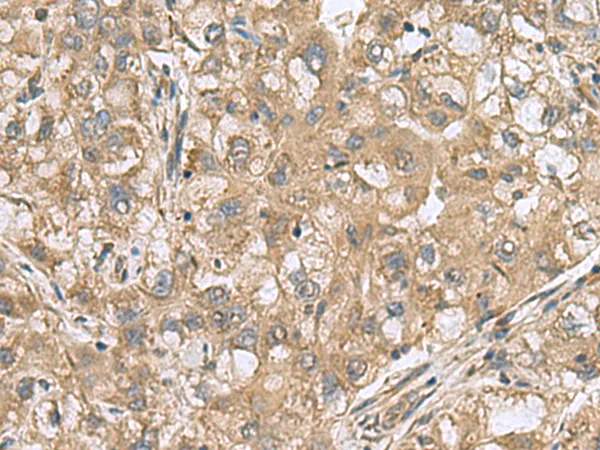 PAPSS2 Rabbit Polyclonal Antibody - image 1