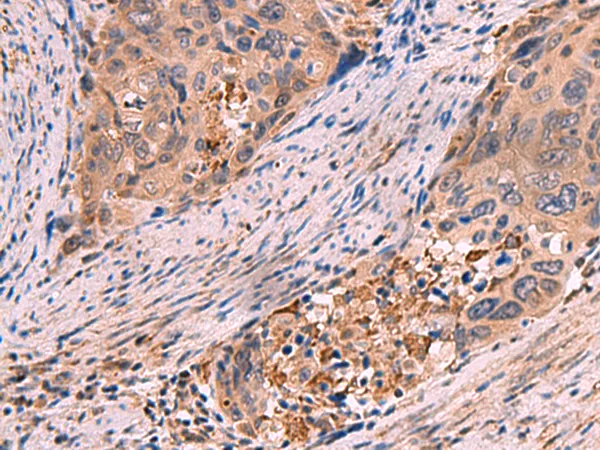 SHC4 Rabbit Polyclonal Antibody - image 1