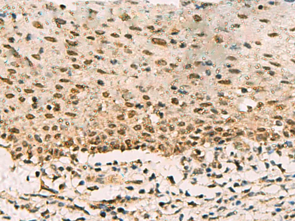PHF5A Rabbit Polyclonal Antibody - image 1