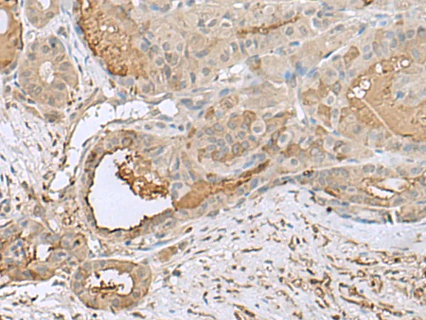GABARAPL2 Rabbit Polyclonal Antibody - image 1
