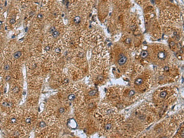 CLASP2 Rabbit Polyclonal Antibody - image 1