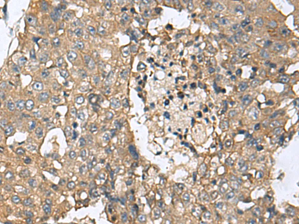 CD59 Rabbit Polyclonal Antibody - image 1
