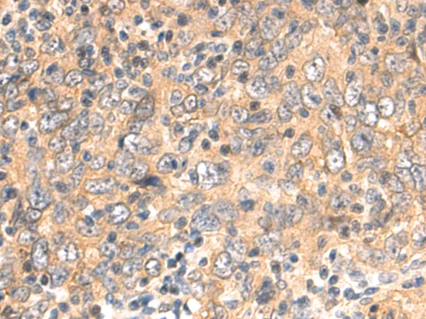 CNBP Rabbit Polyclonal Antibody - image 1