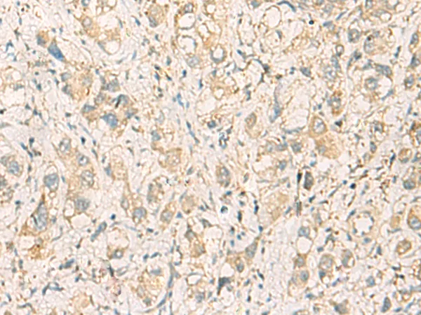 Junctional Adhesion Molecule 1 (F11R) Rabbit Polyclonal Antibody - image 1