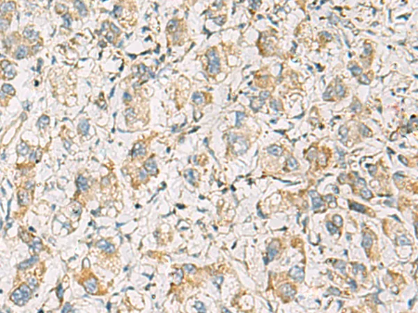 PDE4DIP Rabbit Polyclonal Antibody - image 1