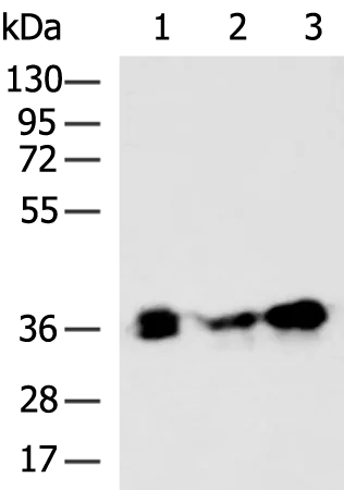 PYCR2 Rabbit Polyclonal Antibody - image 1
