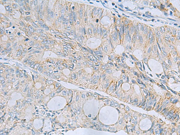 MSI2 Rabbit Polyclonal Antibody - image 1