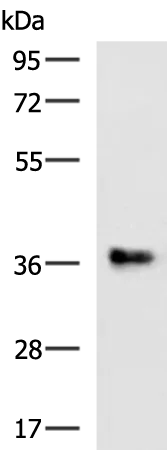 RFC5 Rabbit Polyclonal Antibody - image 1