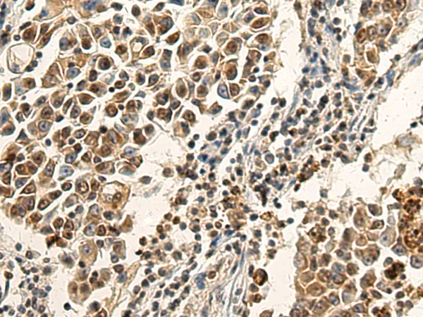 CD2BP2 Rabbit Polyclonal Antibody - image 1