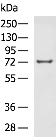 Glucosidase 2 subunit beta (PRKCSH) Rabbit Polyclonal Antibody - image 1