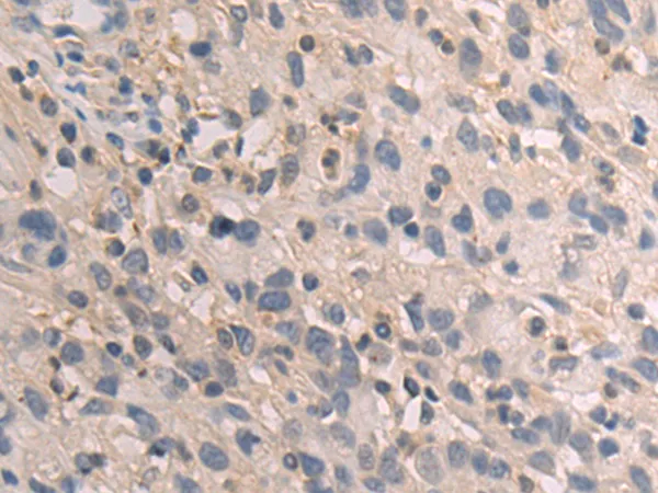 GBE1 Rabbit Polyclonal Antibody - image 1