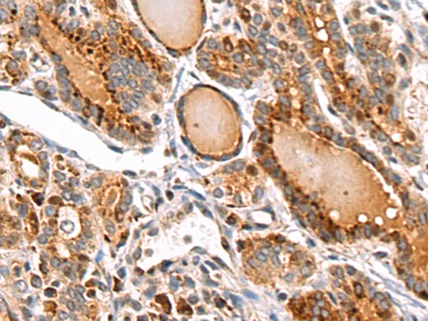 MID2 Rabbit Polyclonal Antibody - image 1