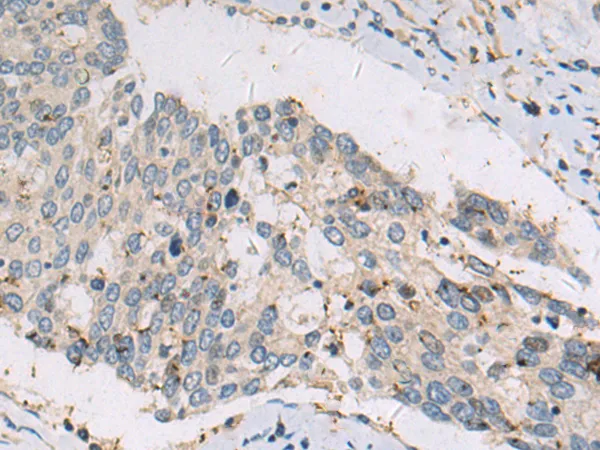 DHTKD1 Rabbit Polyclonal Antibody - image 1