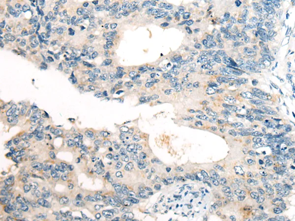 FGF5 Rabbit Polyclonal Antibody - image 1