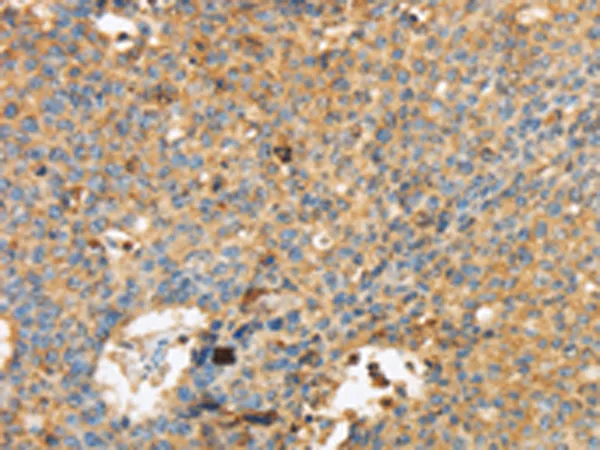 MAPK6 Rabbit Polyclonal Antibody - image 1