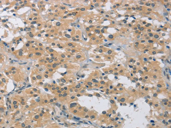 Fos B (FOSB) Rabbit Polyclonal Antibody - image 1