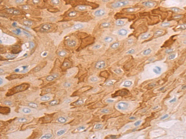 TTF2 Rabbit Polyclonal Antibody - image 1