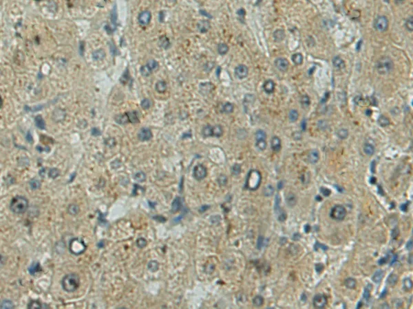 TLR9 Rabbit Polyclonal Antibody - image 1