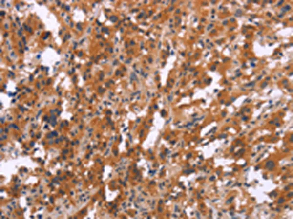 MAPK11 Rabbit Polyclonal Antibody - image 1
