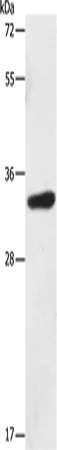 MAGEA3 Rabbit Polyclonal Antibody - image 1