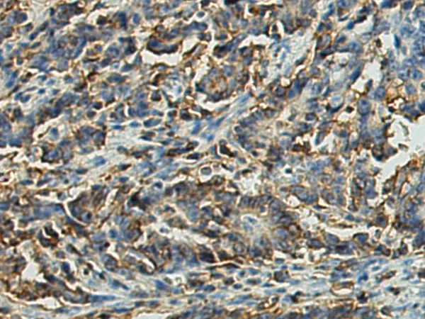 CD44 Rabbit Polyclonal Antibody - image 1