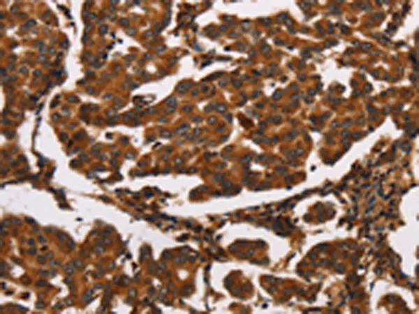 ARSB Rabbit Polyclonal Antibody - image 1