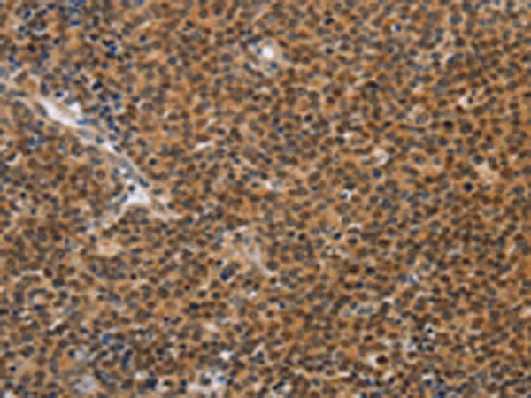 CD36 Rabbit Polyclonal Antibody - image 1
